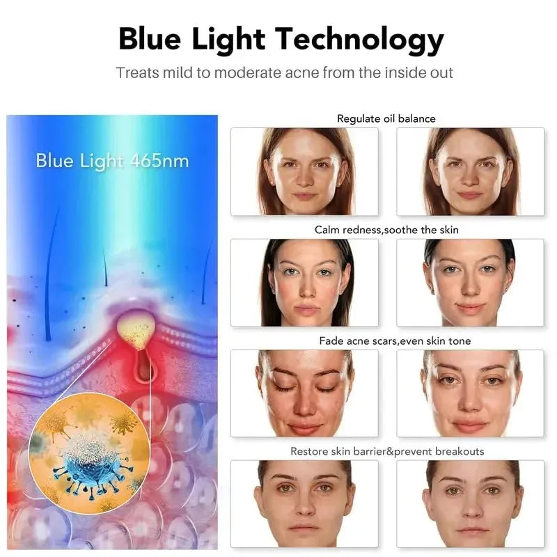 GlowUP LED Facial Therapy Mask